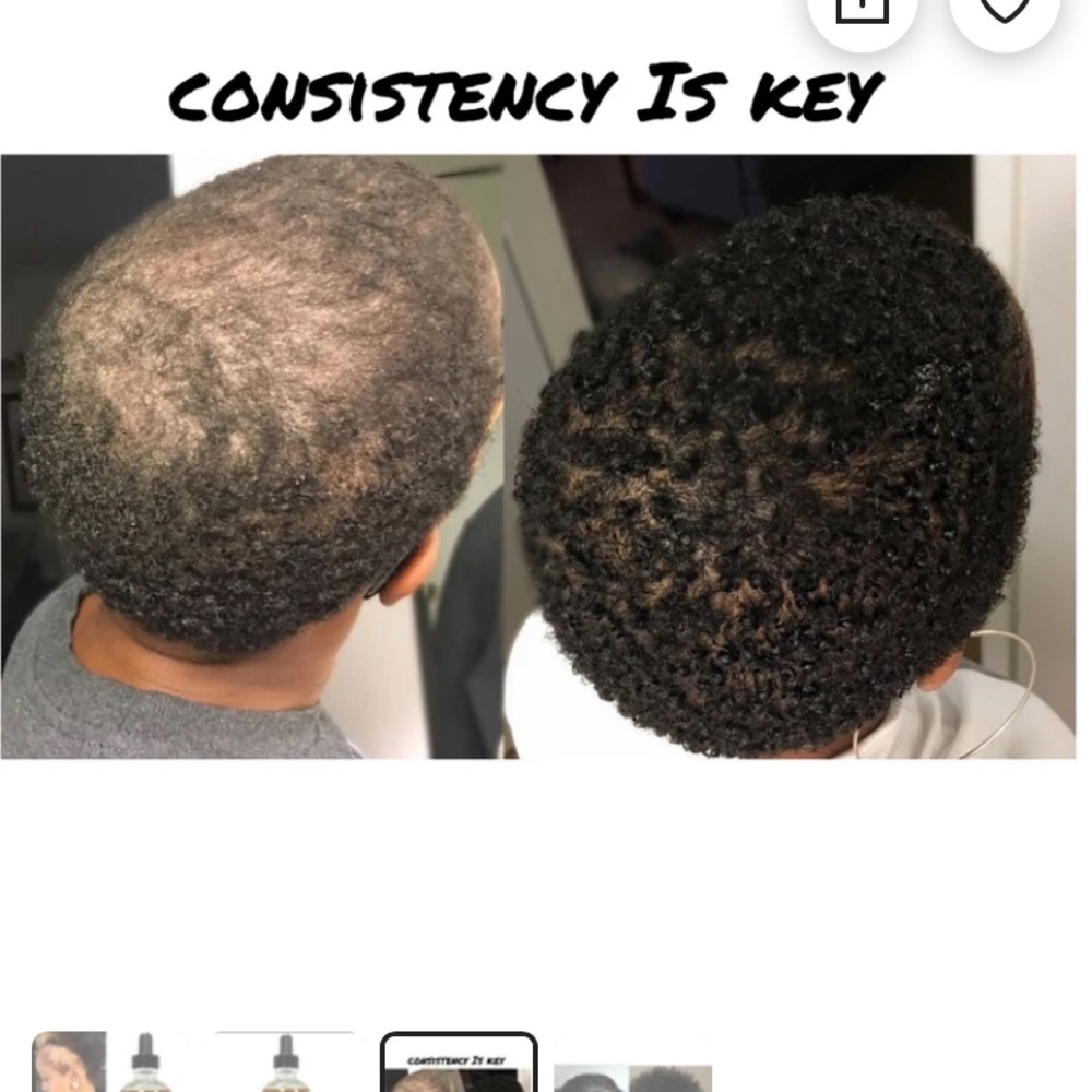Hair growth Serum by Sofia Lemonis
